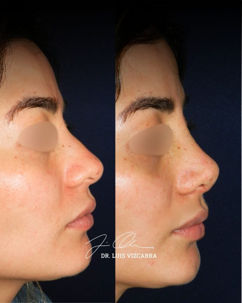 copia de post dr luis